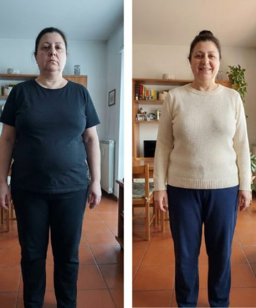 Prima e dopo dimagranti